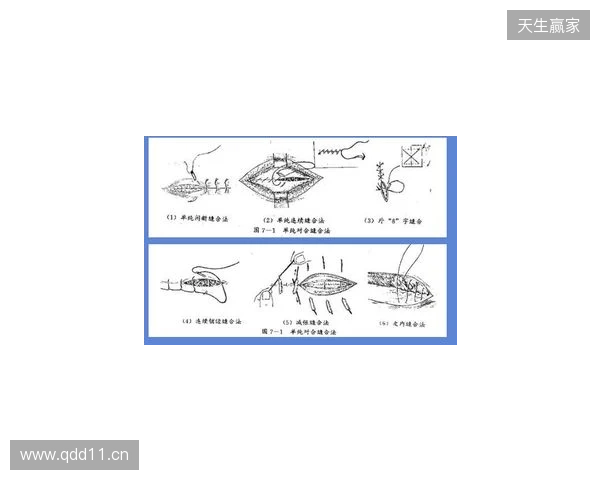 广州豹官方:杨浩眉弓伤口缝合30余针,预计5-7天后拆线